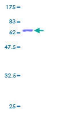 12.5% SDS-PAGE Stained with Coomassie Blue.