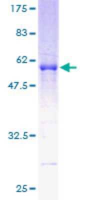 12.5% SDS-PAGE Stained with Coomassie Blue.