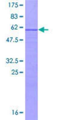 Other Recombinant Human UTP11L GST (N-Term) Protein