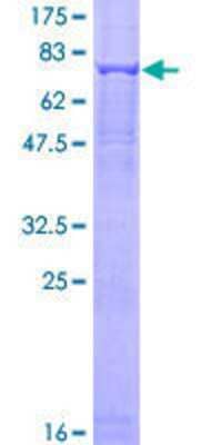 12.5% SDS-PAGE Stained with Coomassie Blue.