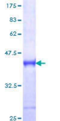 Other Recombinant Human IRAK4 GST (N-Term) Protein