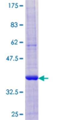 12.5% SDS-PAGE Stained with Coomassie Blue.