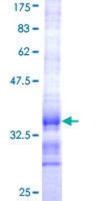 12.5% SDS-PAGE Stained with Coomassie Blue.