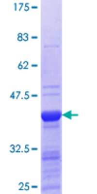 12.5% SDS-PAGE Stained with Coomassie Blue.