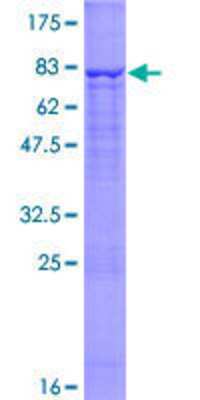 12.5% SDS-PAGE Stained with Coomassie Blue.