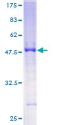 12.5% SDS-PAGE Stained with Coomassie Blue.