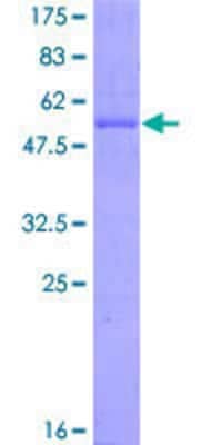 12.5% SDS-PAGE Stained with Coomassie Blue.