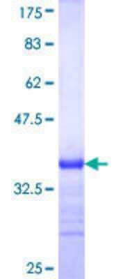 Other Recombinant Human NAGPA GST (N-Term) Protein