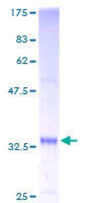 12.5% SDS-PAGE Stained with Coomassie Blue.