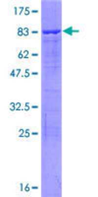 12.5% SDS-PAGE Stained with Coomassie Blue.