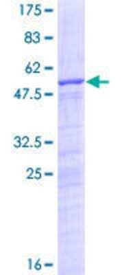 12.5% SDS-PAGE Stained with Coomassie Blue.