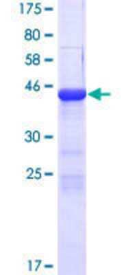 12.5% SDS-PAGE Stained with Coomassie Blue.