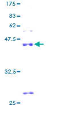 12.5% SDS-PAGE Stained with Coomassie Blue.