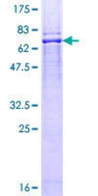 12.5% SDS-PAGE Stained with Coomassie Blue.