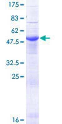 12.5% SDS-PAGE Stained with Coomassie Blue.