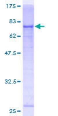 12.5% SDS-PAGE Stained with Coomassie Blue.
