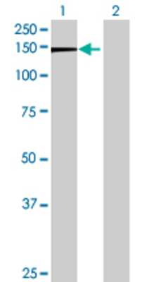 Lane 1: C5orf5 transfected lysate (100.76 KDa) Lane 2: Non-transfected lysate.