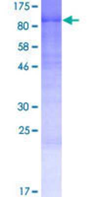 Recombinant Human WAC GST (N-Term) Protein (H00051322-P01): Novus ...