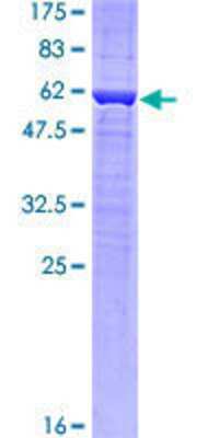 12.5% SDS-PAGE Stained with Coomassie Blue.