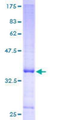 12.5% SDS-PAGE Stained with Coomassie Blue.