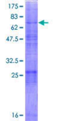 12.5% SDS-PAGE Stained with Coomassie Blue.