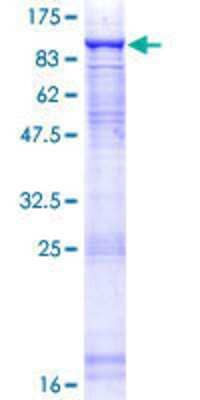 12.5% SDS-PAGE Stained with Coomassie Blue.