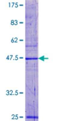Other Recombinant Human RPP20 GST (N-Term) Protein