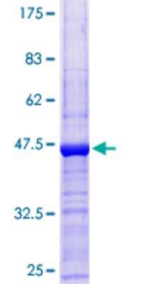12.5% SDS-PAGE Stained with Coomassie Blue.