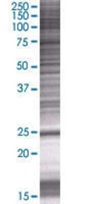 COMMD10 transfected lysate.