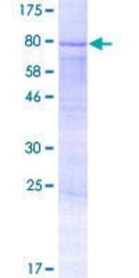 12.5% SDS-PAGE Stained with Coomassie Blue.