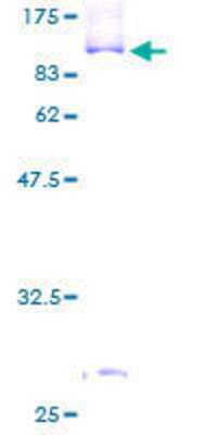 12.5% SDS-PAGE Stained with Coomassie Blue.