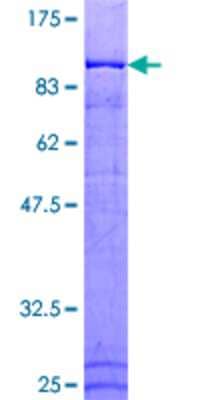 12.5% SDS-PAGE Stained with Coomassie Blue.