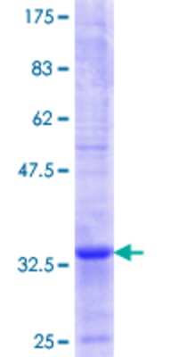 12.5% SDS-PAGE Stained with Coomassie Blue.