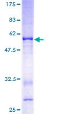 12.5% SDS-PAGE Stained with Coomassie Blue.