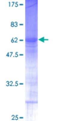 12.5% SDS-PAGE Stained with Coomassie Blue.