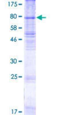 12.5% SDS-PAGE Stained with Coomassie Blue.