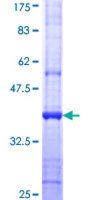 12.5% SDS-PAGE Stained with Coomassie Blue.