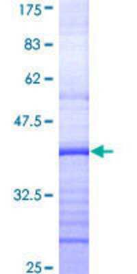 12.5% SDS-PAGE Stained with Coomassie Blue.