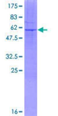 12.5% SDS-PAGE Stained with Coomassie Blue.