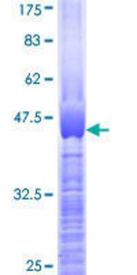 12.5% SDS-PAGE Stained with Coomassie Blue.