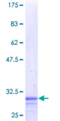 12.5% SDS-PAGE Stained with Coomassie Blue.