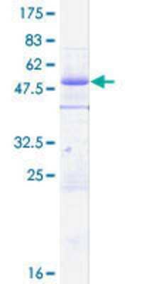 12.5% SDS-PAGE Stained with Coomassie Blue.