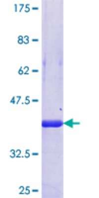 12.5% SDS-PAGE Stained with Coomassie Blue.