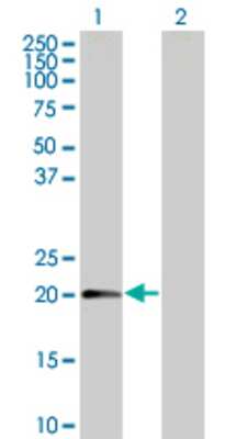 Lane 1: MTP18 transfected lysate (18 KDa) Lane 2: Non-transfected lysate.