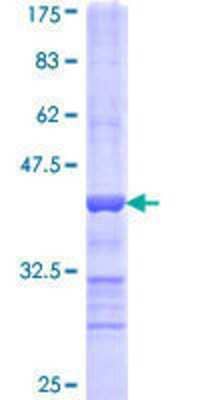 12.5% SDS-PAGE Stained with Coomassie Blue.