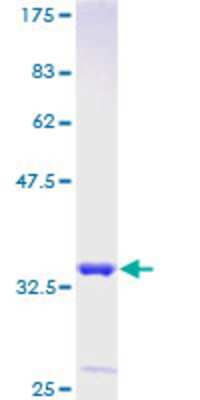 12.5% SDS-PAGE Stained with Coomassie Blue.
