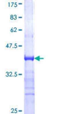 12.5% SDS-PAGE Stained with Coomassie Blue.