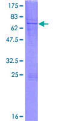 12.5% SDS-PAGE Stained with Coomassie Blue.