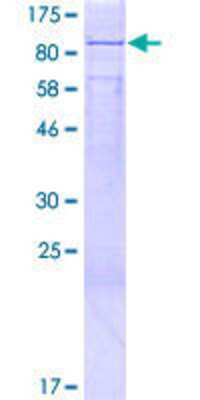 12.5% SDS-PAGE Stained with Coomassie Blue.
