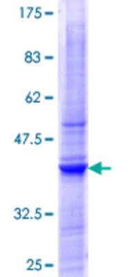12.5% SDS-PAGE Stained with Coomassie Blue.